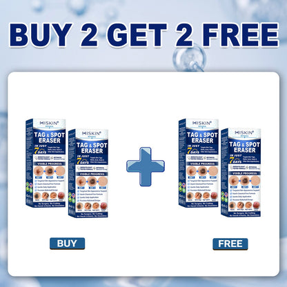 Wait — one last thing before you go…  We have a small overstock batch that didn’t go into regular sale.  👉 You can add 1 more Hiskin® for 80% OFF  ⚠ This is NOT a public offer ⚠ Once this page is closed, it’s gone