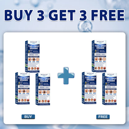 Wait — one last thing before you go…  We have a small overstock batch that didn’t go into regular sale.  👉 You can add 1 more Hiskin® for 80% OFF  ⚠ This is NOT a public offer ⚠ Once this page is closed, it’s gone