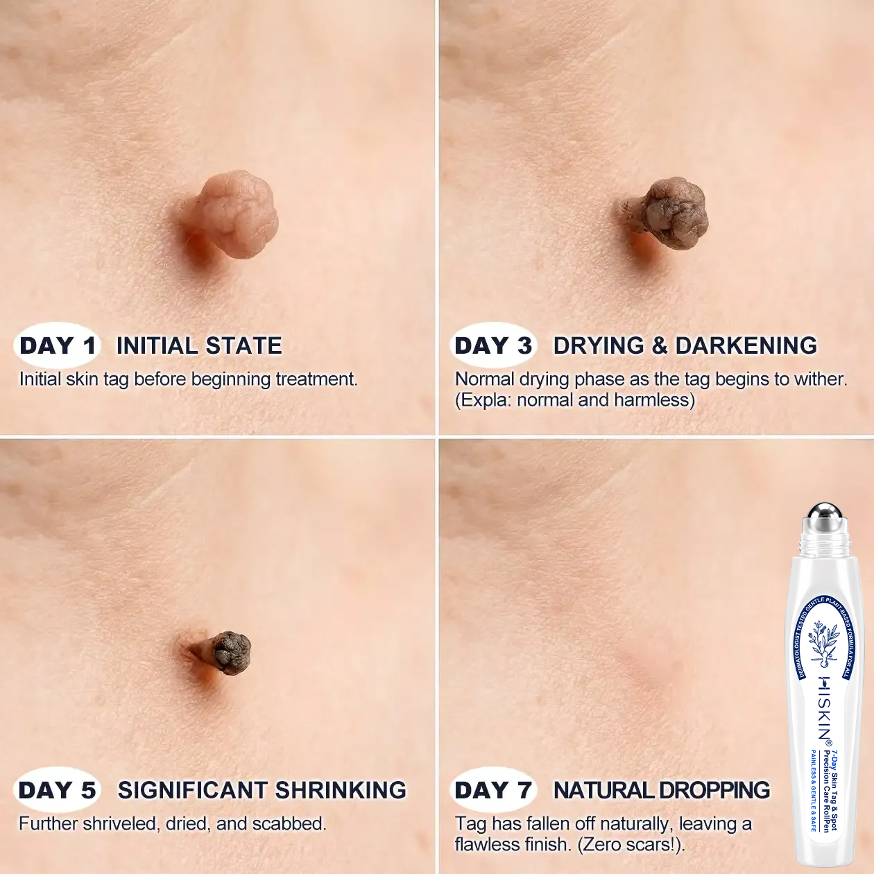Wait — one last thing before you go…  We have a small overstock batch that didn’t go into regular sale.  👉 You can add 1 more Hiskin® for 80% OFF  ⚠ This is NOT a public offer ⚠ Once this page is closed, it’s gone